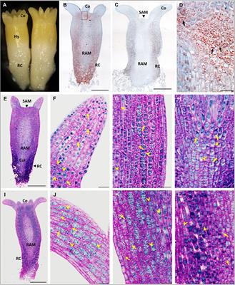 Desiccation as a Post-maturation Treatment Helps Complete Maturation of Norway Spruce Somatic Embryos: Carbohydrates, Phytohormones and Proteomic Status